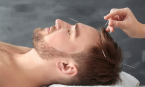 The miracle of Acupunctures